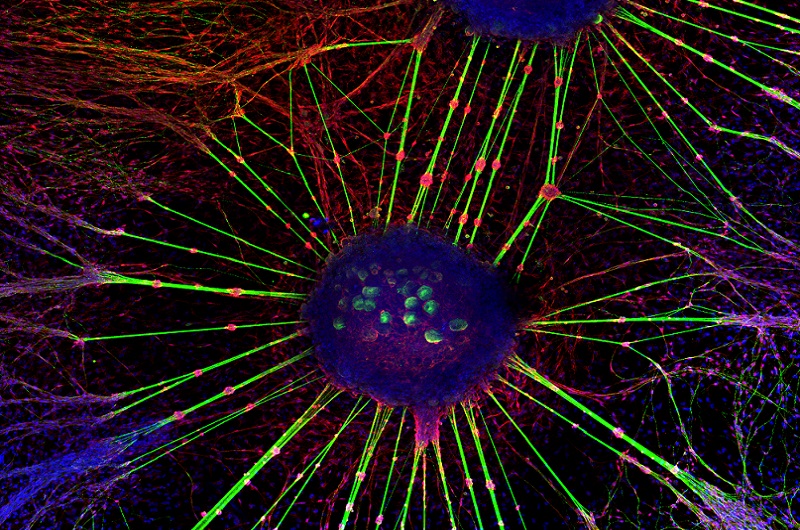 Resultado del concurso de NeuroART 2018 (modalidad de imágenes y de vídeos)