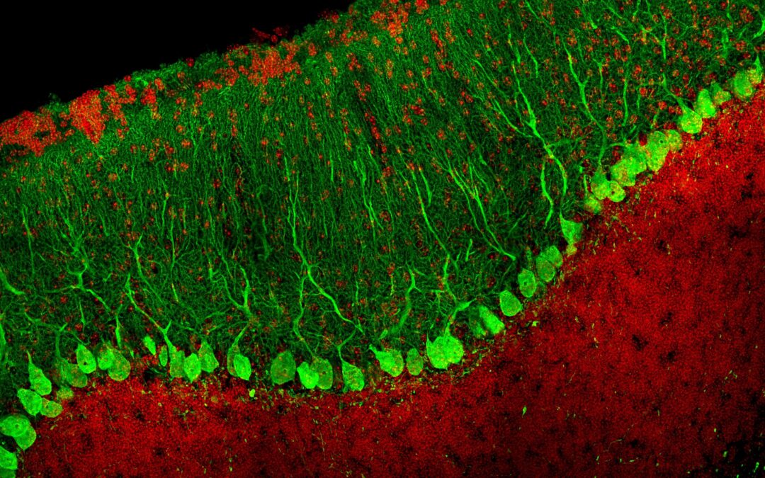 UNIA International Workshop on Synaptic Mechanisms in Health and Disease